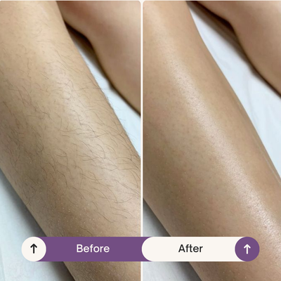Truror® Silk Touch