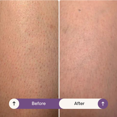 Truror® Silk Touch